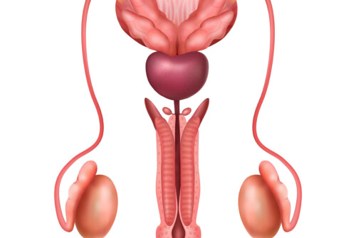 Cancer de la prostate
